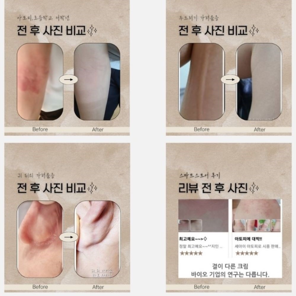 젠바이오크림후기